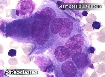 Photo au microscope d'ostéoclastes